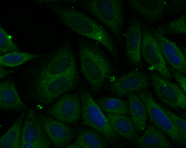 ICC staining PHF8 in SiHa cells (green). The nuclear counter stain is DAPI (blue). Cells were fixed in paraformaldehyde, permeabilised with 0.25% Triton X100/PBS.
