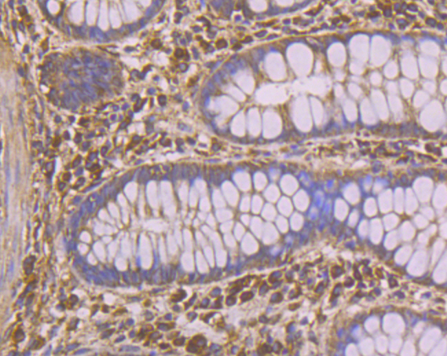 Immunohistochemical analysis of paraffin-embedded human colon tissue using anti-PHF8 antibody. Counter stained with hematoxylin.