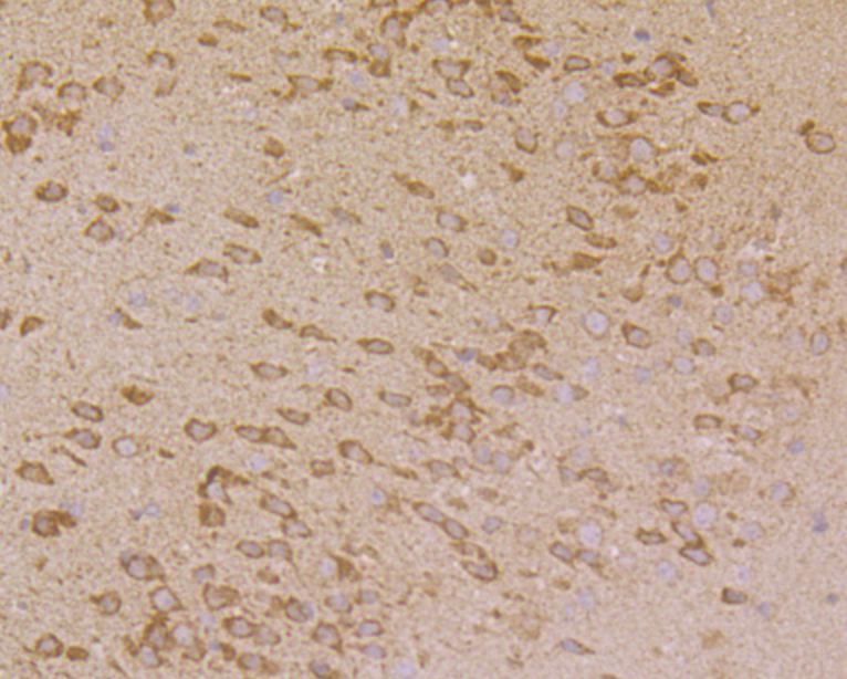 Immunohistochemical analysis of paraffin-embedded mouse brain tissue using anti-PHF8 antibody. Counter stained with hematoxylin.