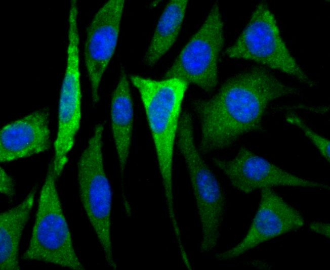 ICC staining CACNG3 in SH-SY-5Y cells (green). The nuclear counter stain is DAPI (blue). Cells were fixed in paraformaldehyde, permeabilised with 0.25% Triton X100/PBS.
