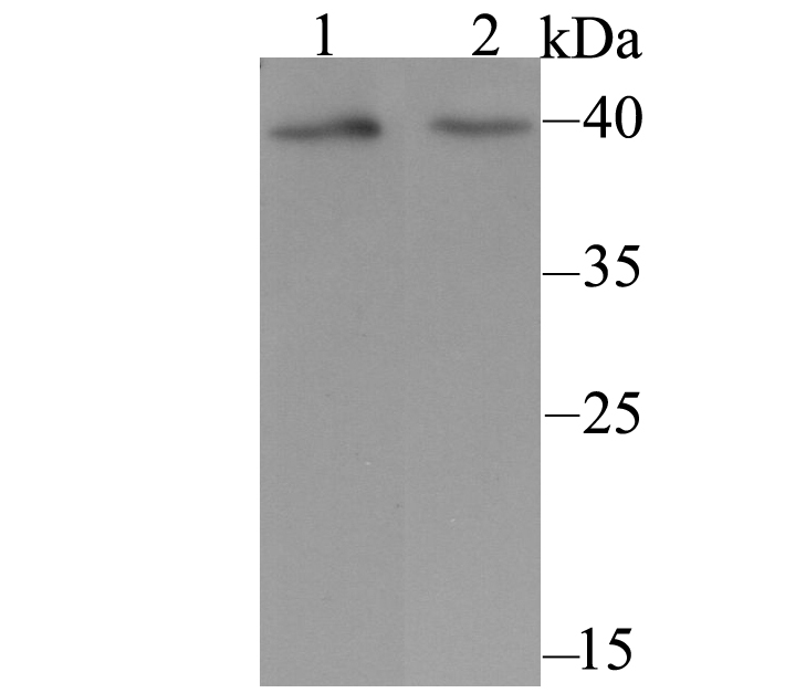 Western blot analysis of KCNK1 on different cell lysate using anti-KCNK1 antibody at 1/500 dilution.<br />
 Positive control:<br />
 Lane 1: Human placenta<br />
   Lane 2: Human liver