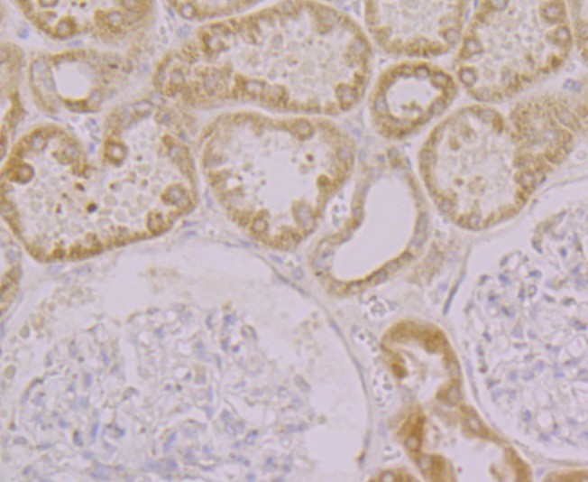 Immunohistochemical analysis of paraffin-embedded human kidney tissue using anti-KCNK1 antibody. Counter stained with hematoxylin.