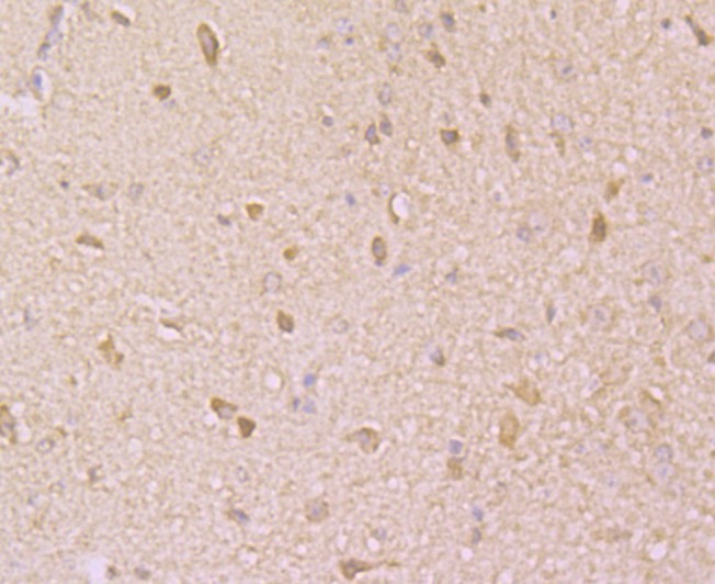Immunohistochemical analysis of paraffin-embedded mouse brain tissue using anti-KCNK1 antibody. Counter stained with hematoxylin.
