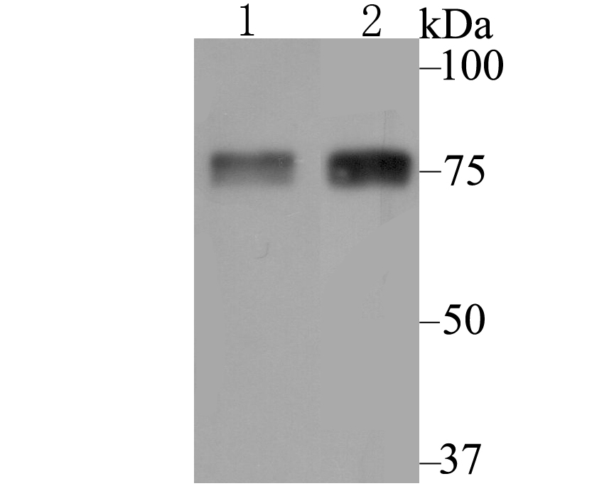 Western blot analysis of LOXL2 on A549 and A431 cell lysate using anti-LOXL2 antibody at 1/500 dilution.