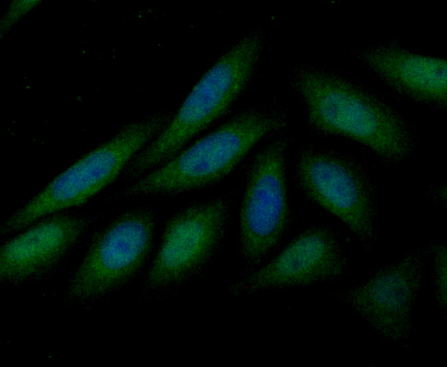 ICC staining LOXL2 in SiHa cells (green). The nuclear counter stain is DAPI (blue). Cells were fixed in paraformaldehyde, permeabilised with 0.25% Triton X100/PBS.