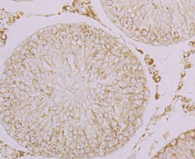 Immunohistochemical analysis of paraffin-embedded rat testis tissue using anti-LOXL2 antibody. Counter stained with hematoxylin. The section was pretreated using heat mediated antigen retrieval with sodium citrate buffer (pH6) for 20 mins.