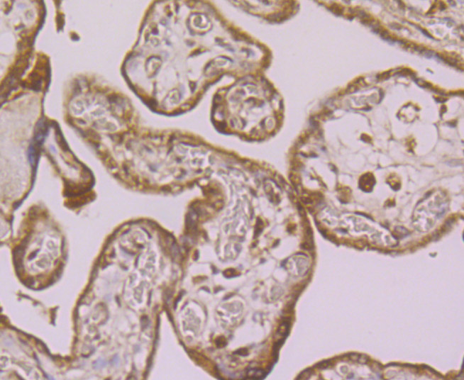 Immunohistochemical analysis of paraffin-embedded human placenta tissue using anti-LOXL2 antibody. Counter stained with hematoxylin. The section was pretreated using heat mediated antigen retrieval with sodium citrate buffer (pH6) for 20 mins.
