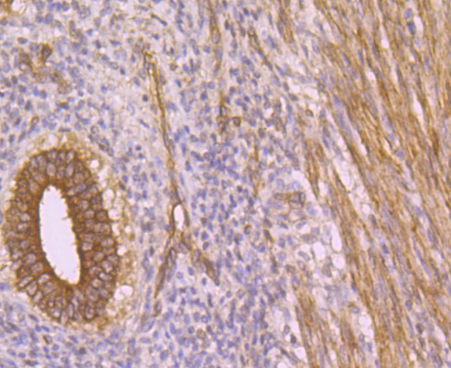 Immunohistochemical analysis of paraffin-embedded human uterus tissue using anti-LOXL2 antibody. Counter stained with hematoxylin. The section was pretreated using heat mediated antigen retrieval with sodium citrate buffer (pH6) for 20 mins.