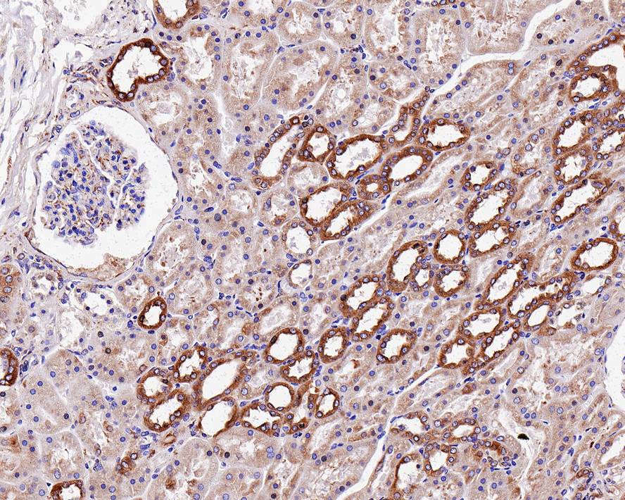 Immunohistochemical analysis of paraffin-embedded human colon tissue using anti-Calnexin antibody. Counter stained with hematoxylin.