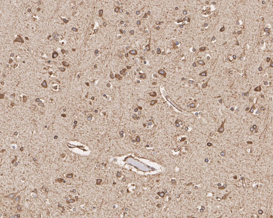 Immunohistochemical analysis of paraffin-embedded human kidney tissue with Rabbit anti-Calnexin antibody (ER1803-42) at 1/500 dilution.<br />
<br />
The section was pre-treated using heat mediated antigen retrieval with Tris-EDTA buffer (pH 9.0) for 20 minutes. The tissues were blocked in 1% BSA for 20 minutes at room temperature, washed with ddH2O and PBS, and then probed with the primary antibody (ER1803-42) at 1/500 dilution for 1 hour at room temperature. The detection was performed using an HRP conjugated compact polymer system. DAB was used as the chromogen. Tissues were counterstained with hematoxylin and mounted with DPX.