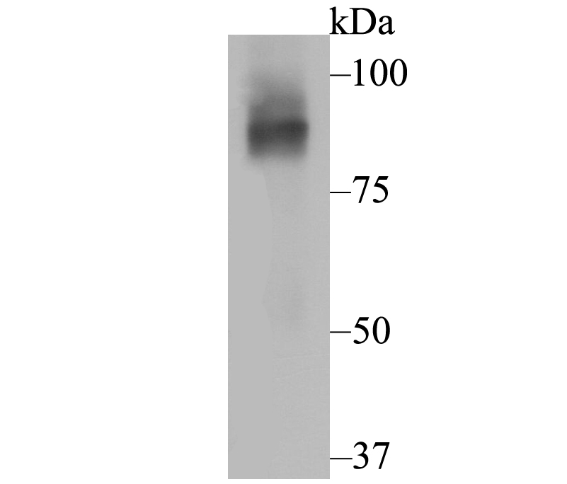 Western blot analysis of CNGA2 on SK-Br-3 cell lysate using anti-CNGA2 antibody at 1/2,000 dilution.