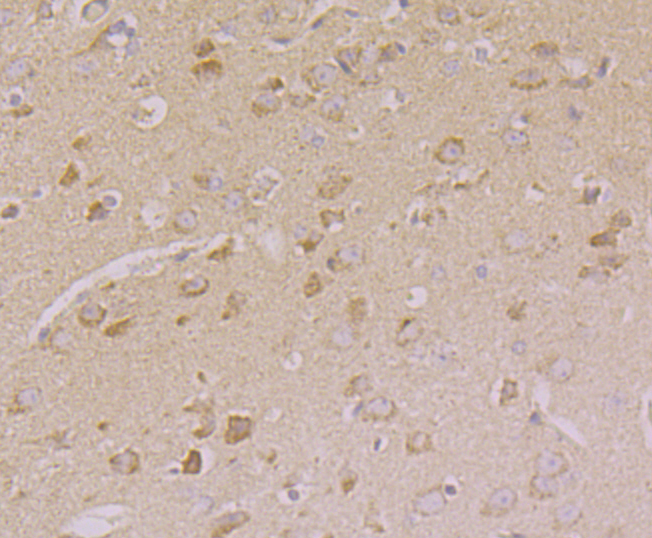 Immunohistochemical analysis of paraffin-embedded mouse brain tissue using anti-CNGA2 antibody. Counter stained with hematoxylin.