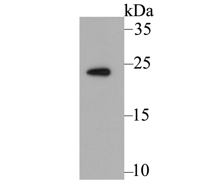 Western blot analysis of Methyltransferase-like 26 on mouse kidney tissue lysate using anti-Methyltransferase-like 26 antibody at 1/500 dilution.