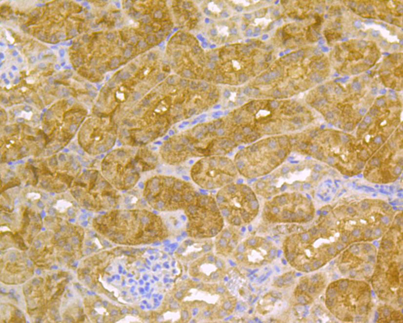 Immunohistochemical analysis of paraffin-embedded mouse kidney tissue using anti-Methyltransferase-like 26 antibody. Counter stained with hematoxylin.