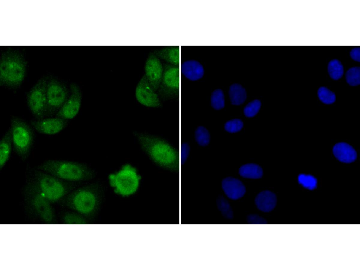 ICC staining Nfic in SiHa cells (green). The nuclear counter stain is DAPI (blue). Cells were fixed in paraformaldehyde, permeabilised with 0.25% Triton X100/PBS.
