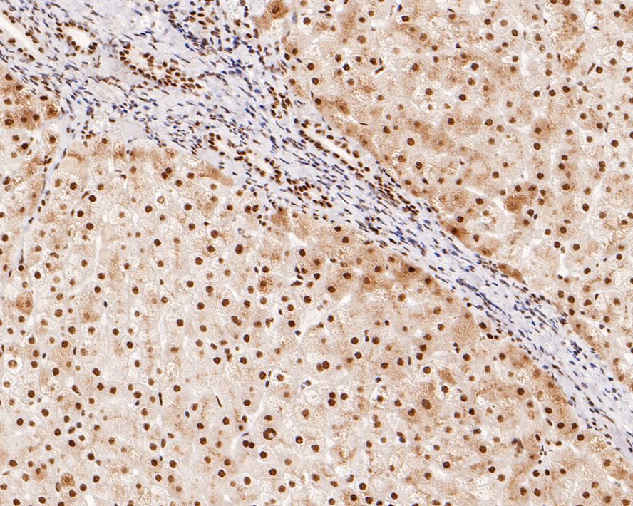 Immunohistochemical analysis of paraffin-embedded human liver tissue using anti-Nfic antibody. Counter stained with hematoxylin. The section was pre-treated using heat mediated antigen retrieval with sodium citrate buffer (pH6) for 20 mins.