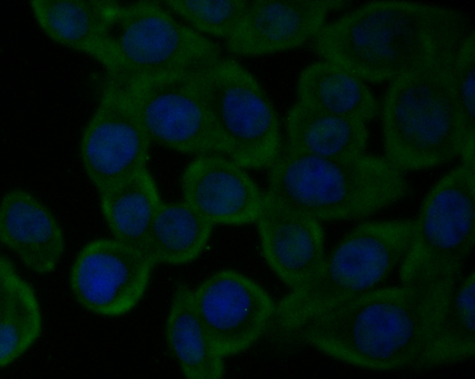 ICC staining CaV2.3 in LOVO cells (green). The nuclear counter stain is DAPI (blue). Cells were fixed in paraformaldehyde, permeabilised with 0.25% Triton X100/PBS.