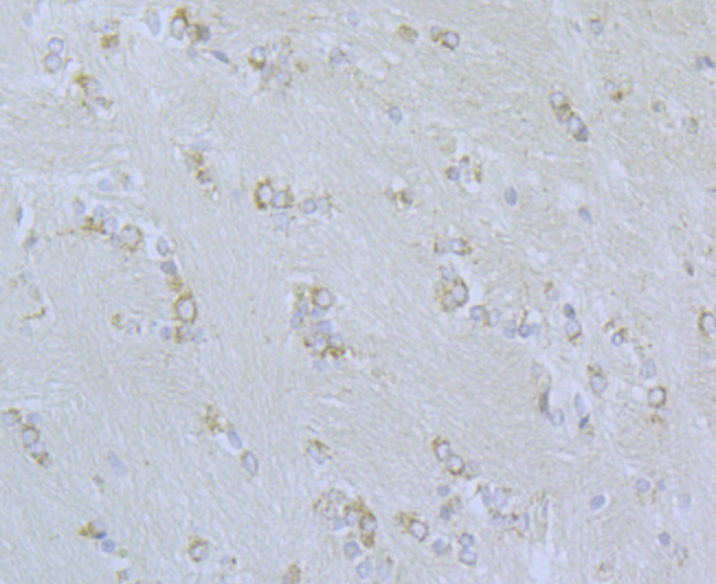 Immunohistochemical analysis of paraffin-embedded rat brain tissue using anti-CaV2.3 antibody. Counter stained with hematoxylin.