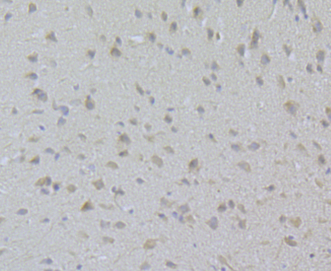 Immunohistochemical analysis of paraffin-embedded mouse testis tissue using anti-CaV2.3 antibody. Counter stained with hematoxylin.