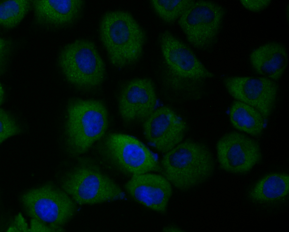 ICC staining Tmem248 in HUVEC cells (green). The nuclear counter stain is DAPI (blue). Cells were fixed in paraformaldehyde, permeabilised with 0.25% Triton X100/PBS.