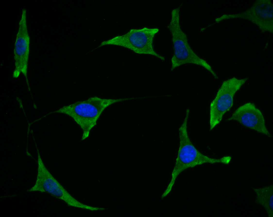 ICC staining Tmem248 in SH-SY-5Y cells (green). The nuclear counter stain is DAPI (blue). Cells were fixed in paraformaldehyde, permeabilised with 0.25% Triton X100/PBS.