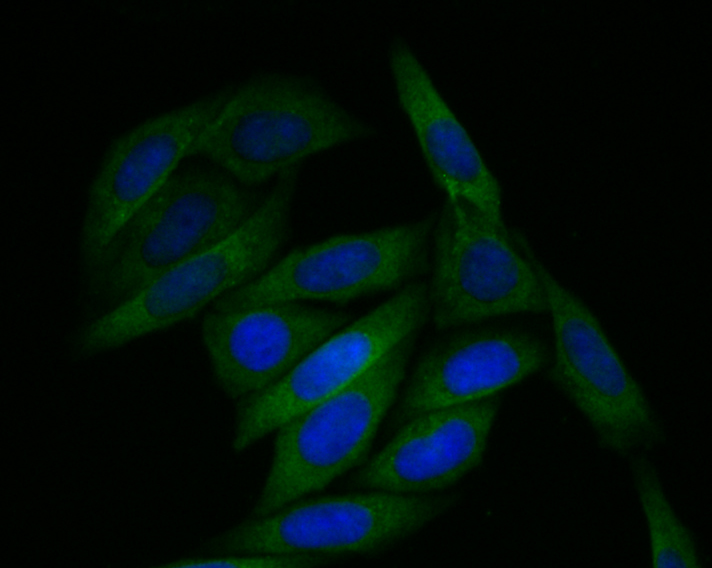 ICC staining Tmem248 in SiHa cells (green). The nuclear counter stain is DAPI (blue). Cells were fixed in paraformaldehyde, permeabilised with 0.25% Triton X100/PBS.
