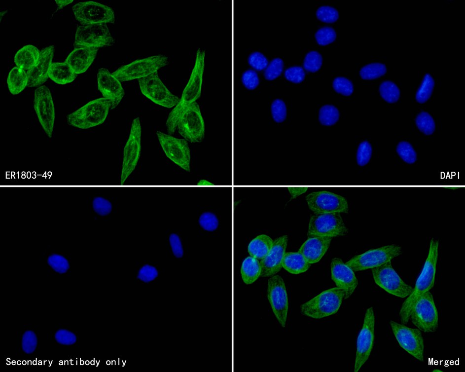 ICC staining of CACNA1C in SiHa cells (green). Formalin fixed cells were permeabilized with 0.1% Triton X-100 in TBS for 10 minutes at room temperature and blocked with 10% negative goat serum for 15 minutes at room temperature. Cells were probed with the primary antibody (ER1803-49, 1/200) for 1 hour at room temperature, washed with PBS. Alexa Fluor®488 conjugate-Goat anti-Rabbit IgG was used as the secondary antibody at 1/1,000 dilution. The nuclear counter stain is DAPI (blue).