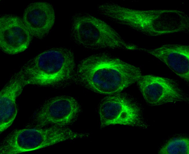 ICC staining of CACNA1C in SKOV-3 cells (green). Formalin fixed cells were permeabilized with 0.1% Triton X-100 in TBS for 10 minutes at room temperature and blocked with 10% negative goat serum for 15 minutes at room temperature. Cells were probed with the primary antibody (ER1803-49, 1/200) for 1 hour at room temperature, washed with PBS. Alexa Fluor®488 conjugate-Goat anti-Rabbit IgG was used as the secondary antibody at 1/1,000 dilution. The nuclear counter stain is DAPI (blue).