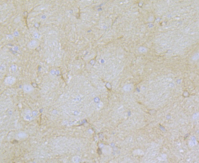 Immunohistochemical analysis of paraffin-embedded rat brain tissue using anti-CACNA1C antibody. The section was pre-treated using heat mediated antigen retrieval with Tris-EDTA buffer (pH 9.0) for 20 minutes.The tissues were blocked in 1% BSA for 30 minutes at room temperature, washed with ddH2O and PBS, and then probed with the primary antibody (ER1803-49, 1/50) for 30 minutes at room temperature. The detection was performed using an HRP conjugated compact polymer system. DAB was used as the chromogen. Tissues were counterstained with hematoxylin and mounted with DPX.