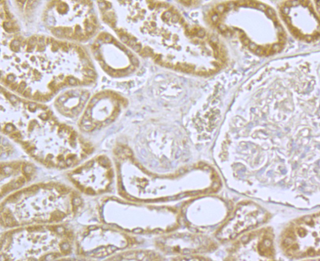 Immunohistochemical analysis of paraffin-embedded human kidney tissue using anti-CACNA1C antibody. The section was pre-treated using heat mediated antigen retrieval with Tris-EDTA buffer (pH 9.0) for 20 minutes.The tissues were blocked in 1% BSA for 30 minutes at room temperature, washed with ddH2O and PBS, and then probed with the primary antibody (ER1803-49, 1/50) for 30 minutes at room temperature. The detection was performed using an HRP conjugated compact polymer system. DAB was used as the chromogen. Tissues were counterstained with hematoxylin and mounted with DPX.