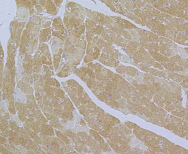 Immunohistochemical analysis of paraffin-embedded mouse heart tissue using anti-CACNA1C antibody. The section was pre-treated using heat mediated antigen retrieval with Tris-EDTA buffer (pH 9.0) for 20 minutes.The tissues were blocked in 1% BSA for 30 minutes at room temperature, washed with ddH2O and PBS, and then probed with the primary antibody (ER1803-49, 1/50) for 30 minutes at room temperature. The detection was performed using an HRP conjugated compact polymer system. DAB was used as the chromogen. Tissues were counterstained with hematoxylin and mounted with DPX.