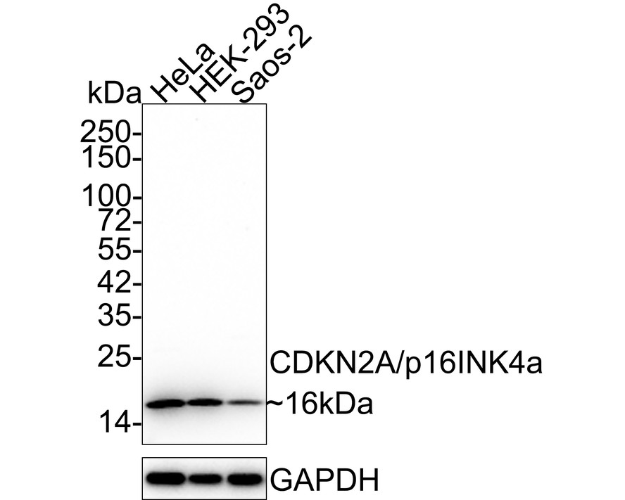 Western blot analysis of CDKN2A/p16INK4a on SiHa cell lysate using anti-CDKN2A/p16INK4a antibody at 1/500 dilution.<br />
 Positive control:<br />
 Lane 1: SiHa cell lysate<br />
 Lane 2: SiHa cell lysate with immunization peptide