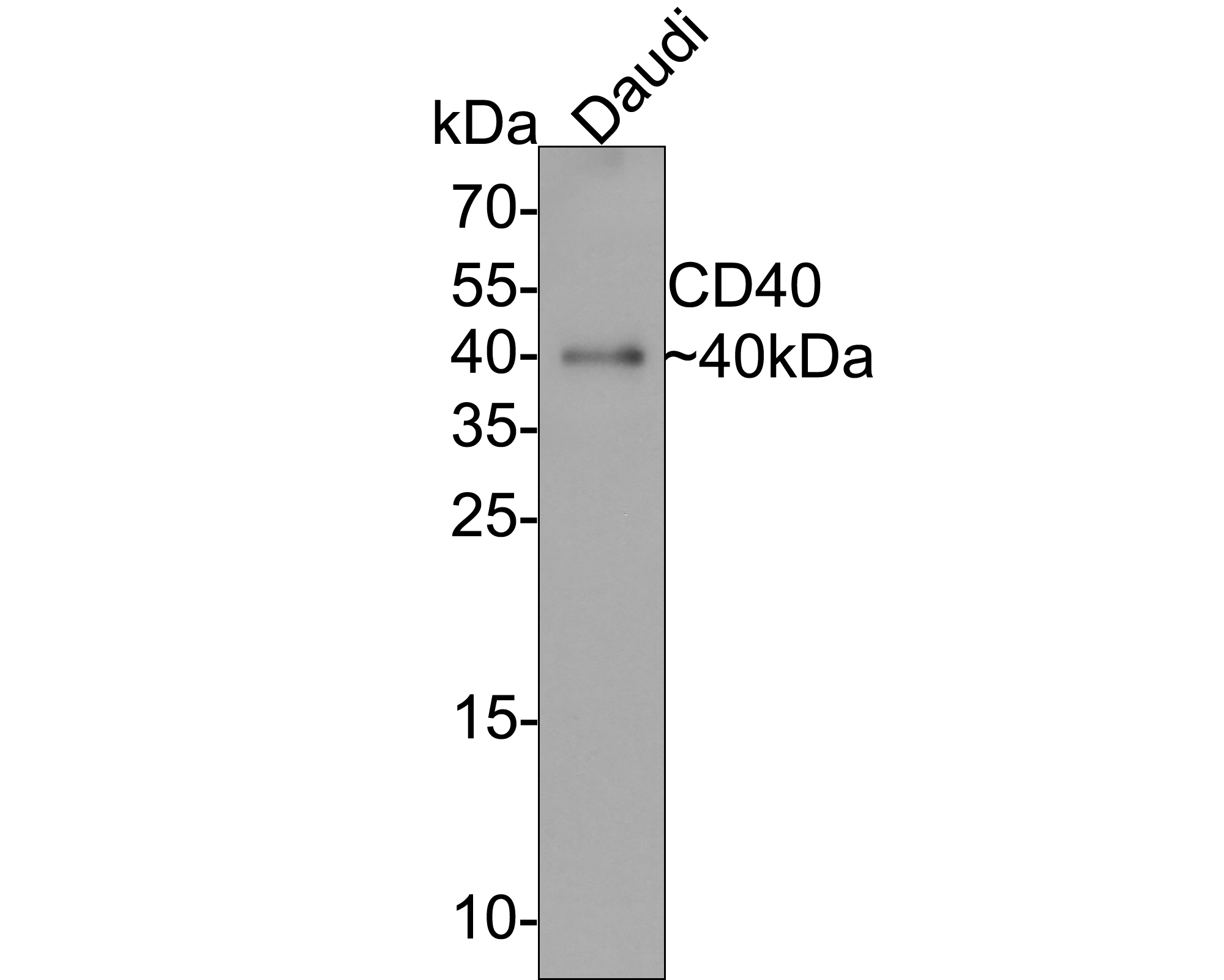 Western blot analysis of CD40 on Daudi cell lysates with Rabbit anti-CD40 antibody (ER1803-54) at 1/2,000 dilution.<br />
<br />
Lysates/proteins at 10 µg/Lane.<br />
<br />
Predicted band size: 31 kDa<br />
Observed band size: 40 kDa<br />
<br />
Exposure time: 1 minute;<br />
<br />
15% SDS-PAGE gel.<br />
<br />
Proteins were transferred to a PVDF membrane and blocked with 5% NFDM/TBST for 1 hour at room temperature. The primary antibody (ER1803-54) at 1/2,000 dilution was used in 5% NFDM/TBST at room temperature for 2 hours. Goat Anti-Rabbit IgG - HRP Secondary Antibody (HA1001) at 1:300,000 dilution was used for 1 hour at room temperature.