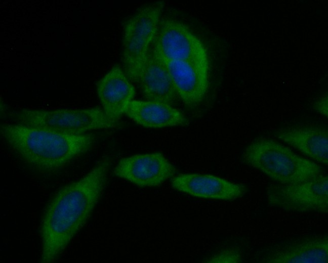 ICC staining CD40 in MG-63 cells (green). The nuclear counter stain is DAPI (blue). Cells were fixed in paraformaldehyde, permeabilised with 0.25% Triton X100/PBS.
