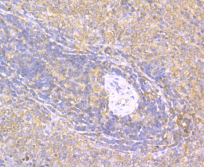 ICC staining CD40 in SiHa cells (green). The nuclear counter stain is DAPI (blue). Cells were fixed in paraformaldehyde, permeabilised with 0.25% Triton X100/PBS.