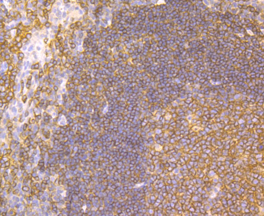 Immunohistochemical analysis of paraffin-embedded human tonsil tissue using anti-CD40 antibody. Counter stained with hematoxylin.