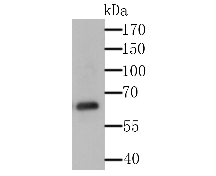 Western blot analysis of USP14 on Daudi cell lysate using anti-USP14 antibody at 1/500 dilution.