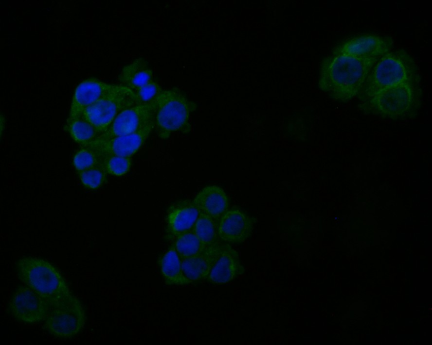 ICC staining MCU in A431 cells (green). The nuclear counter stain is DAPI (blue). Cells were fixed in paraformaldehyde, permeabilised with 0.25% Triton X100/PBS.