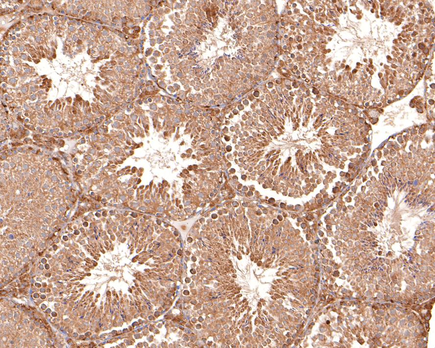 Immunohistochemical analysis of paraffin-embedded rat cerebellum tissue using anti-MCU antibody. Counter stained with hematoxylin.