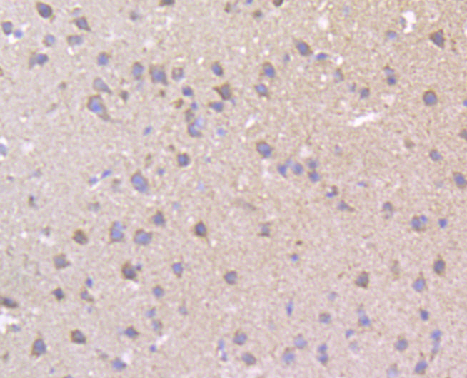 Immunohistochemical analysis of paraffin-embedded mouse brain tissue using anti-MCU antibody. Counter stained with hematoxylin.