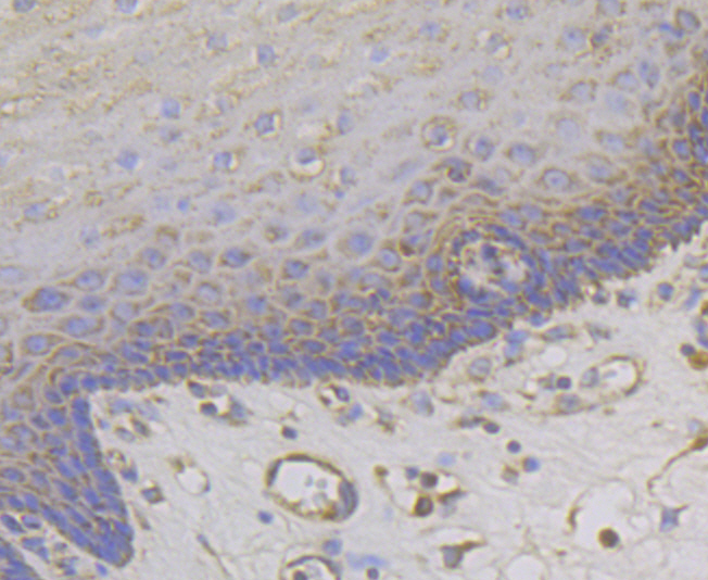 Immunohistochemical analysis of paraffin-embedded human esophagus tissue using anti-MCU antibody. Counter stained with hematoxylin.