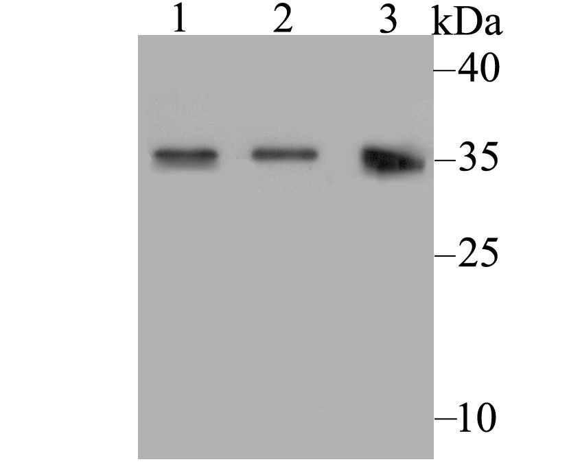 Western blot analysis of Connexin-32 on different lysates using anti-Connexin-32 antibody at 1/500 dilution.<br />
 Positive control:<br />
 Lane 1: PC-3M<br />
              Lane 2: A431<br />
 Lane 3: Human skin tissue
