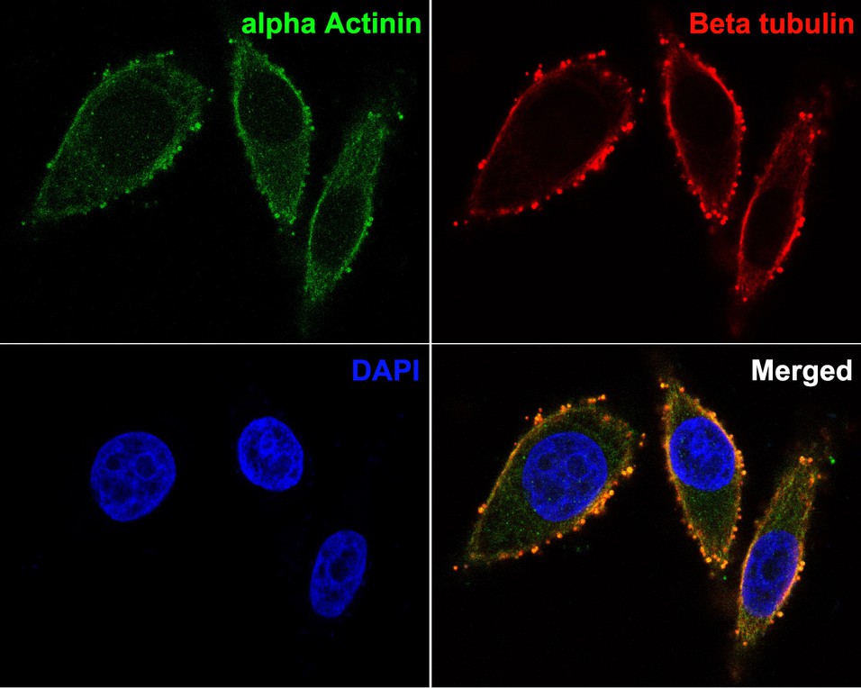 Immunocytochemistry analysis of Siha cells labeling alpha Actinin with Rabbit anti-alpha Actinin antibody (ER1803-60) at 1/200 dilution.<br />
<br />
Cells were fixed in 4% paraformaldehyde for 10 minutes at 37 ℃, permeabilized with 0.05% Triton X-100 in PBS for 20 minutes, and then blocked with 2% negative goat serum for 30 minutes at room temperature. Cells were then incubated with Rabbit anti-alpha Actinin antibody (ER1803-60) at 1/200 dilution in 2% negative goat serum overnight at 4 ℃. Goat Anti-Rabbit IgG H&L (iFluor™ 488, HA1121) was used as the secondary antibody at 1/1,000 dilution. Nuclear DNA was labelled in blue with DAPI.<br />
<br />
Beta tubulin (M1305-2, red) was stained at 1/100 dilution overnight at +4℃. Goat Anti-Mouse IgG H&L (iFluor™ 647, HA1127) were used as the secondary antibody at 1/1,000 dilution.