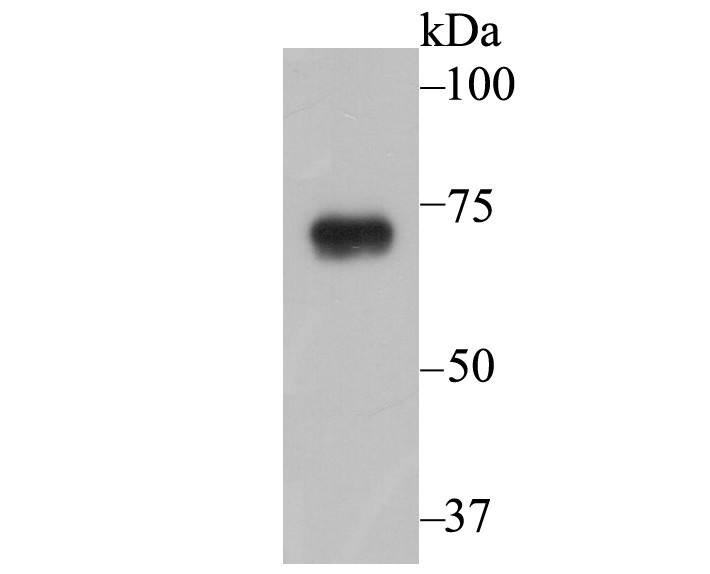 Western blot analysis of SCNN1G on A431cell lysates. Proteins were transferred to a PVDF membrane and blocked with 5% BSA in PBS for 1 hour at room temperature. The primary antibody (ER1803-61, 1/1,000) was used in 5% BSA at room temperature for 2 hours. Goat Anti-Rabbit IgG - HRP Secondary Antibody (HA1001) at 1:200,000 dilution was used for 1 hour at room temperature.