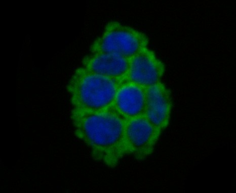 ICC staining of SCNN1G in 293T cells (green). Formalin fixed cells were permeabilized with 0.1% Triton X-100 in TBS for 10 minutes at room temperature and blocked with 10% negative goat serum for 15 minutes at room temperature. Cells were probed with the primary antibody (ER1803-61, 1/50) for 1 hour at room temperature, washed with PBS. Alexa Fluor®488 conjugate-Goat anti-Rabbit IgG was used as the secondary antibody at 1/1,000 dilution. The nuclear counter stain is DAPI (blue).