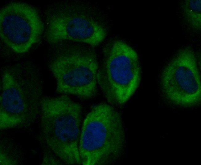 ICC staining of SCNN1G in A431 cells (green). Formalin fixed cells were permeabilized with 0.1% Triton X-100 in TBS for 10 minutes at room temperature and blocked with 10% negative goat serum for 15 minutes at room temperature. Cells were probed with the primary antibody (ER1803-61, 1/50) for 1 hour at room temperature, washed with PBS. Alexa Fluor®488 conjugate-Goat anti-Rabbit IgG was used as the secondary antibody at 1/1,000 dilution. The nuclear counter stain is DAPI (blue).