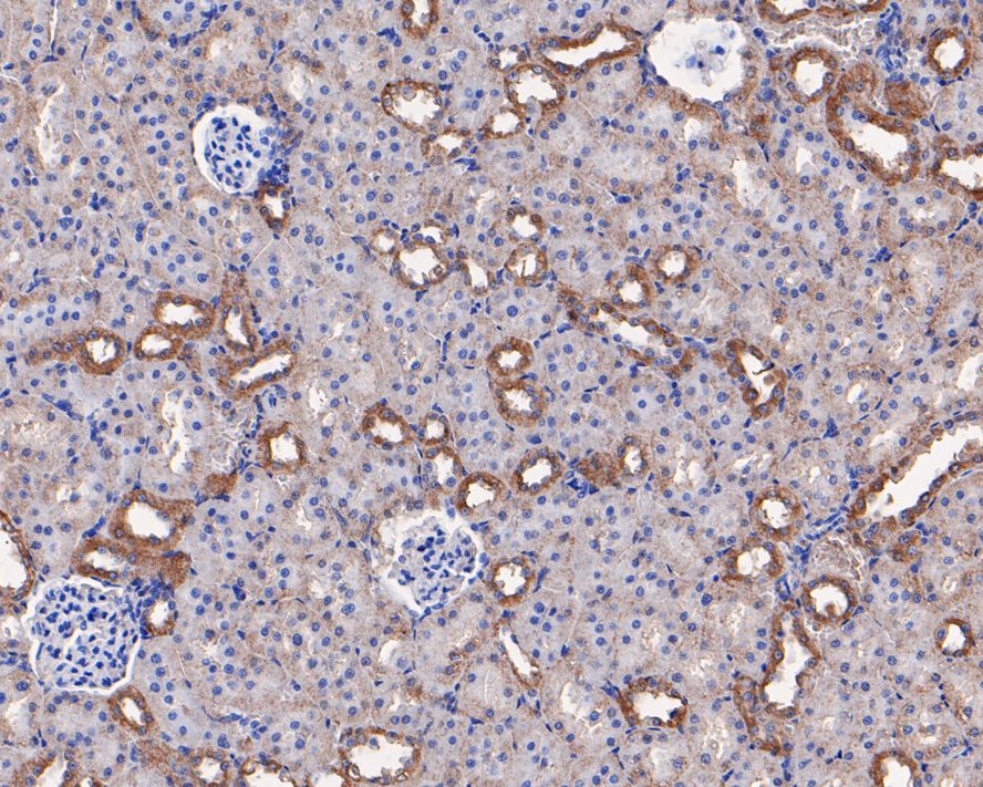 Immunohistochemical analysis of paraffin-embedded rat kidney tissue using anti-SCNN1G antibody. The section was pre-treated using heat mediated antigen retrieval with Tris-EDTA buffer (pH 9.0) for 20 minutes.The tissues were blocked in 1% BSA for 30 minutes at room temperature, washed with ddH2O and PBS, and then probed with the primary antibody (ER1803-61, 1/50) for 30 minutes at room temperature. The detection was performed using an HRP conjugated compact polymer system. DAB was used as the chromogen. Tissues were counterstained with hematoxylin and mounted with DPX.