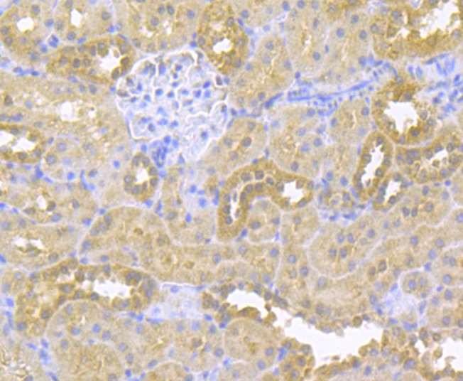 Immunohistochemical analysis of paraffin-embedded mouse brain tissue using anti-SCNN1G antibody. The section was pre-treated using heat mediated antigen retrieval with Tris-EDTA buffer (pH 9.0) for 20 minutes.The tissues were blocked in 1% BSA for 30 minutes at room temperature, washed with ddH2O and PBS, and then probed with the primary antibody (ER1803-61, 1/50) for 30 minutes at room temperature. The detection was performed using an HRP conjugated compact polymer system. DAB was used as the chromogen. Tissues were counterstained with hematoxylin and mounted with DPX.