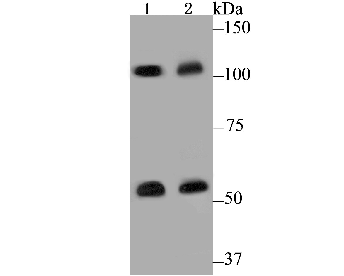 Western blot analysis of CASK on different cell lysate using anti-CASK antibody at 1/500 dilution.<br />
 Positive control:<br />
 Lane 1: SiHa<br />
           Lane 2: A549