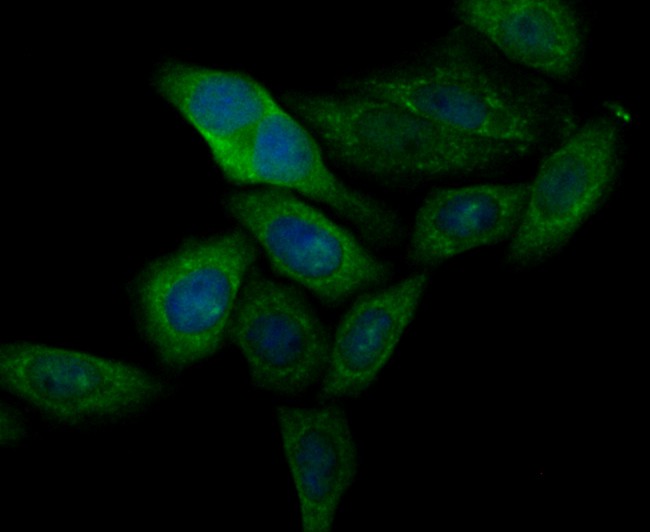 ICC staining CASK in HT-29 cells (green). The nuclear counter stain is DAPI (blue). Cells were fixed in paraformaldehyde, permeabilised with 0.25% Triton X100/PBS.